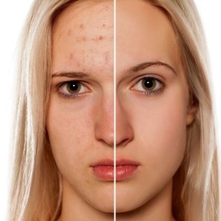 Догляд за шкірою обличчя за допомогою корейської косметики - bshop